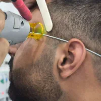 لیزر موی زائد تاریخ های۱۵و۱۶و۱۷و۱۸و۱۹و۲۰اردیبهشت