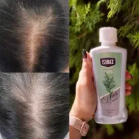 تونیک‌هیرفرند