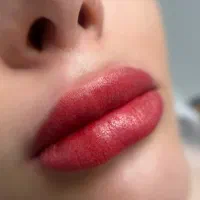 شیدینگ لب و رفع کبودی لب به صورت تخصصی و تضمینی