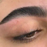 اصلاح تخصصی ابروکاملانچرال