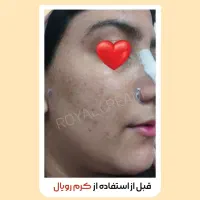 اگه دنبال پوست خوبی پیام بده|آرایشی، بهداشتی، درمانی|خلخال, |دیوار