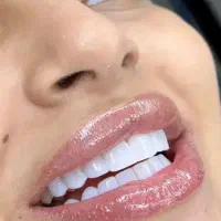 فک 6 تومان  کامپوزیت دندان نانو سرامیک بهترین مواد