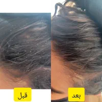 شپش و رشک تخصصی