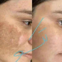 کاهش اشتها،لاغری،پاکسازی کبد،کیست وتنبلی تخمدان|خوردنی و آشامیدنی|تربت‌حیدریه, حسنی بالا|دیوار