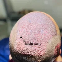 جشنواره‌پایزه‌کاشت‌موریش‌وابروشیرازی‌دراردبیل‌قساط|خدمات آرایشگری و زیبایی|اردبیل, |دیوار