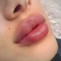 مدل تزریق ژل و بوتاکس و آموزش در کلینیک زیبایی|خدمات آرایشگری و زیبایی|کرج, چهارصد دستگاه|دیوار