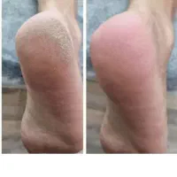 پدیکور وکف سابی پا مخصوص خانم ها|خدمات آرایشگری و زیبایی|مشهد, فتح المبین|دیوار