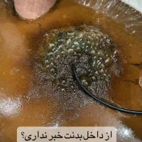 سم زدایی بدن برای بانوان و آقایان