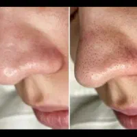 انجام خدمات زیبایی زنان|خدمات آرایشگری و زیبایی|تهران, شهرک شریعتی|دیوار