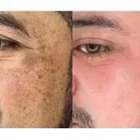 جشنواره تضمینی/تخصصی لک و کک مک فقط تا امشب