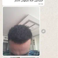 کاشتمو تضمینی شیراز|خدمات آرایشگری و زیبایی|شیراز, قصرالدشت|دیوار