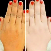 فرمول سفیدکننده دست وپا