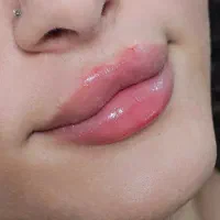 خدمات زیبایی‌ و جوانسازی‌ پوست شما