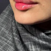 فیلر هر برندی مشتری بخواد|خدمات آرایشگری و زیبایی|یاسوج, |دیوار