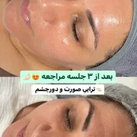 پاکسازی پوست فیشال پوست فیشیال پوست|خدمات آرایشگری و زیبایی|تهران, مجیدیه|دیوار