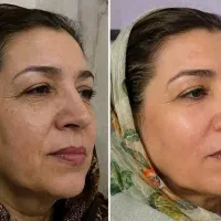 کرم بیوممتیک اصل ۱۵ کاره|آرایشی، بهداشتی، درمانی|قم, دورشهر|دیوار