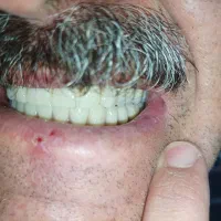 لابراتوار دندانسازی، دندان مصنوعی|آرایشی، بهداشتی، درمانی|تبریز, |دیوار