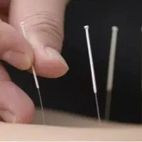 آموزش خصوصی طب سوزنی و امبدینگ