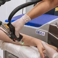 لیزر موهای زائد دستگاه شاتی دکا