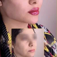 کلینیک پوست زیبایی تزریق ژل390مزوprp لیزر لاغری|خدمات آرایشگری و زیبایی|تهران, ستارخان|دیوار