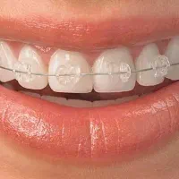 ارتودنسی تخصصی اقساطی