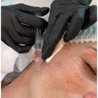 ژل بوتاکس مزوتراپی جوانساز فشیال پاکسازی|خدمات آرایشگری و زیبایی|اندیشه, اندیشه فاز ۱|دیوار