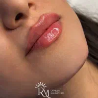 جشنواره  زیبایی کلینیک  دکتر محمودی دیارام