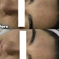 پاکسازی تخصصی پوست صورت|خدمات آرایشگری و زیبایی|اصفهان, فرح آباد|دیوار