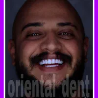 دندانپزشکی اقتصادی/کامپوزیت دندان/عصبکشی/ترمیم|خدمات آرایشگری و زیبایی|تهران, میدان ولیعصر|دیوار