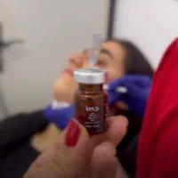 تخفیف ویژه مزوتراپی فیوژن و بوتاکس مصپورت