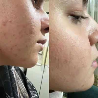 مشاوره پوست ومو|آرایشی، بهداشتی، درمانی|محمدیه-قزوین, |دیوار
