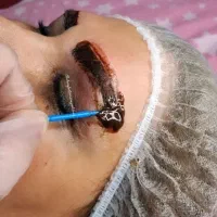 ریموو تک جلسه ای تتوهای قدیمی،کاملا تضمینی