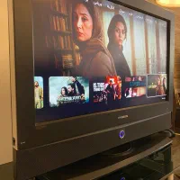 تلویزیون x-vision