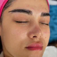 فیشال تخصصی زیر نظر پزشک|خدمات آرایشگری و زیبایی|مسجد سلیمان, |دیوار