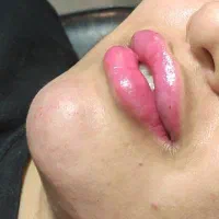 ژل بوتاکس|خدمات آرایشگری و زیبایی|دوگنبدان, |دیوار