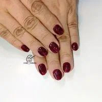 کاشت ترمیم ناخن تخفیف ویژه