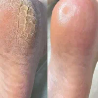 پدیکور تخصصی  و کفسابی