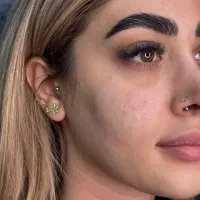 پیرسینگ مطبی گوش غضروف،گوشواره کودک، میکرودرمال