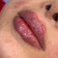 جشنواره *هفت روزه*تزریق ژل و بوتاکس،فیلر،مزوتراپی|خدمات آرایشگری و زیبایی|یاسوج, |دیوار