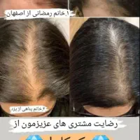 تونیک ضد ریزش مو و تقویت مو|آرایشی، بهداشتی، درمانی|یزد, |دیوار