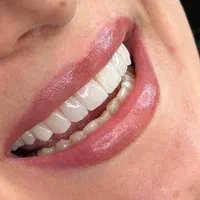 دندانپزشکی/کامپوزیت/لمینیت/ایمپلنت|خدمات آرایشگری و زیبایی|تهران, قبا|دیوار