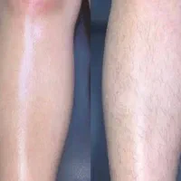 تخفیف به مدت یک هفته(پاکسازی پوست،اپلاسیون،لیفت)|خدمات آرایشگری و زیبایی|گالیکش, |دیوار