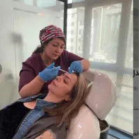 جشنواره ی پاییزه فیلر زیرچشم و شقیقه پی آرپی فیشال