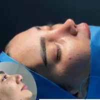 جشنواره ویژه عمل زیبایی بینی توسط متخصص|خدمات آرایشگری و زیبایی|اهواز, کیانپارس |دیوار