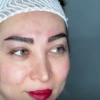 آموزش کاشت مو و ابرو به روش های نوین پزشکی|خدمات آموزشی|تهران, سعادت‌آباد|دیوار