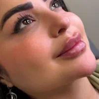 لیزرموهای زائد فول دست پا صورت ژل فیلربادی بوتاکس|خدمات آرایشگری و زیبایی|کرج, گوهردشت|دیوار
