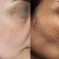 کرم سفیده کننده صددرصد تضمینی|آرایشی، بهداشتی، درمانی|رفسنجان, |دیوار