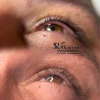 خدمات وآموزش صفرتا صد میکروبلیدینگ ارایش دائم