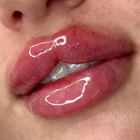 فیلر/ژل لب صورت کاشت مژه روباهی/کایلی..