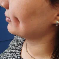 انجام خدمات پیرسینگ وچال گونه|خدمات آرایشگری و زیبایی|رشت, حاجی آباد|دیوار